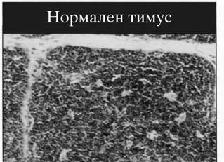 Zrelite T limfociti go napu{taat timusot i recirkuliraat od krvotokot vo sekundarnite limfoidni organi (desno) kako na primer limfni jazli, slezina ili Pajer-ovi plo~i, kade mo`e da sretnat protivgen.