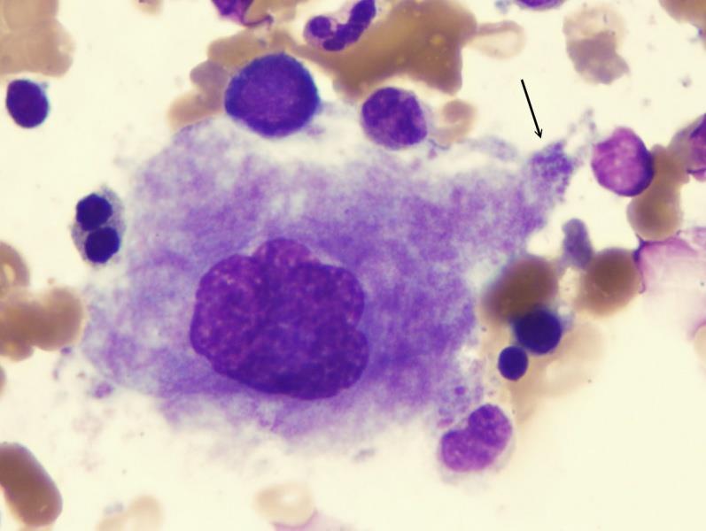 TROMBOCITI ERITOCITI