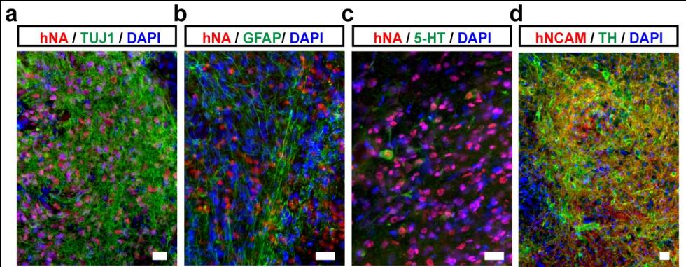 Supplementary Figure 10: Histological analysis of long-term (5 months) grafted 6-OHDA lesioned SD rats.