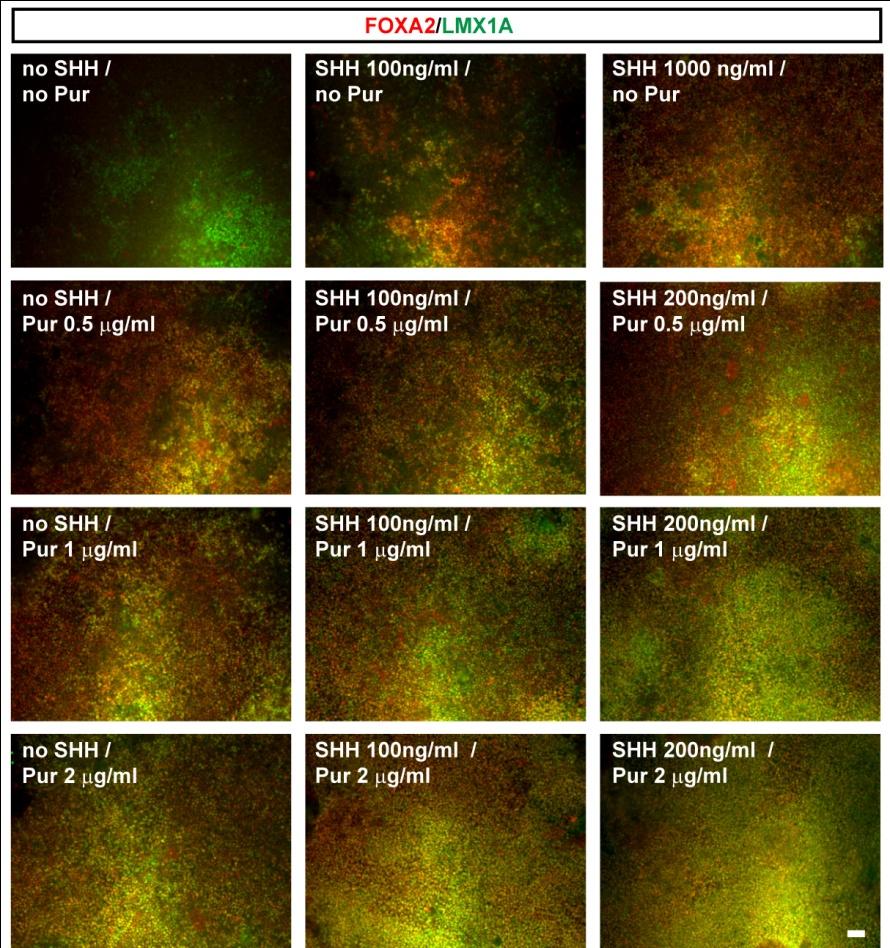 Supplementary Figure 3: Exposure to high dose of SHH and/or a smoothened small molecule agonist (purmorphamine) is required for efficient midbrain floor plate induction in the presence of CHIR99021.