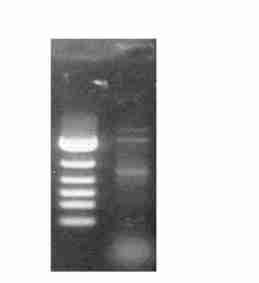 5 : MUC1ΠY 581 GST2Yex 3 4 1 3 ELISA GST GST 2 211 MUC1ΠY cdna P12P2 HeLa RNA DNA ( Fig 2) 795 bp 759 bp (Fig 3) 3 9 bp ; 331 G A (V) (M) MUC1ΠY cdna GenBank(AF125525) Fig 2 RT2PCR of MUC1ΠY cdna