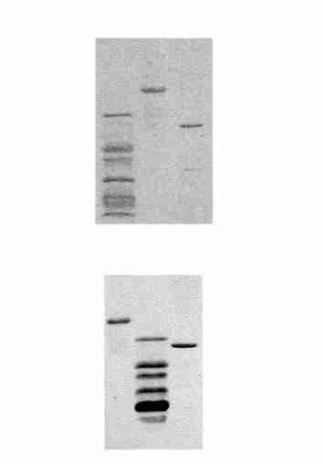 5 : MUC1ΠY 583 Fig 6 Affinity purification and enzyme digestion of GST2Yex 1,5 Protein markers ; 2,4 Affinity purified GST2Yex ; 3 Thrombin digested GST2Yex ; 6 Affinity purified GST V2 M V M [4 ]