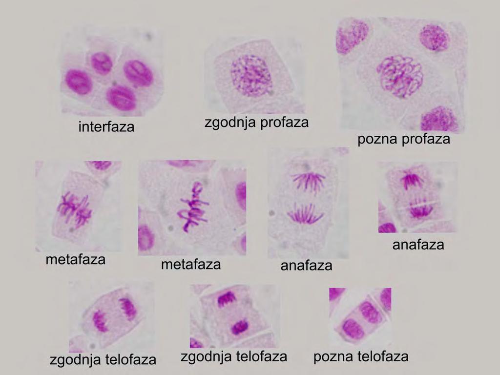 Allium cepa mitoza - jedro (nukleus) - jedrce (nukleolus) - jedrna membrana -