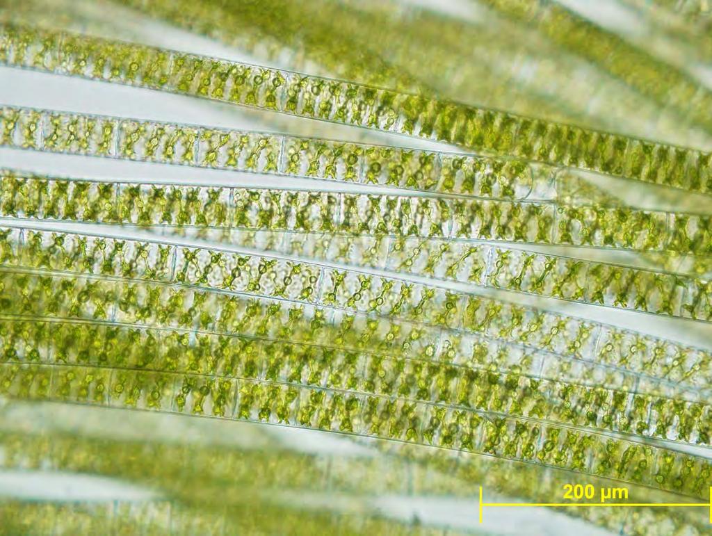 Spirogyra sp.