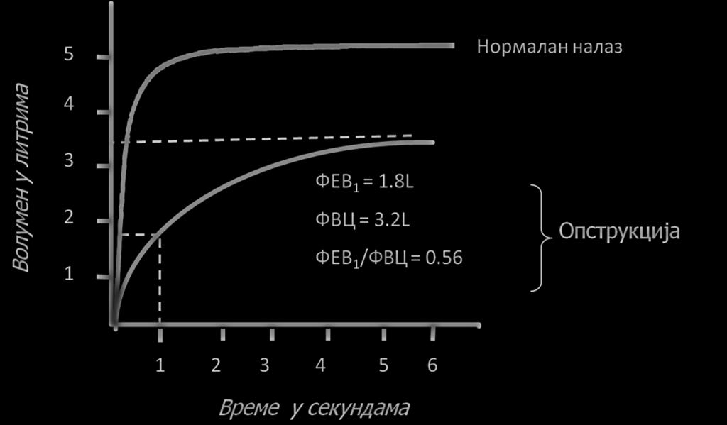 1.3. Дијагноза Карактеристични симптоми ХОБП-а обухватају хроничну, прогресивну диспнеју, кашаљ и продукцију спутума која може бити различита.