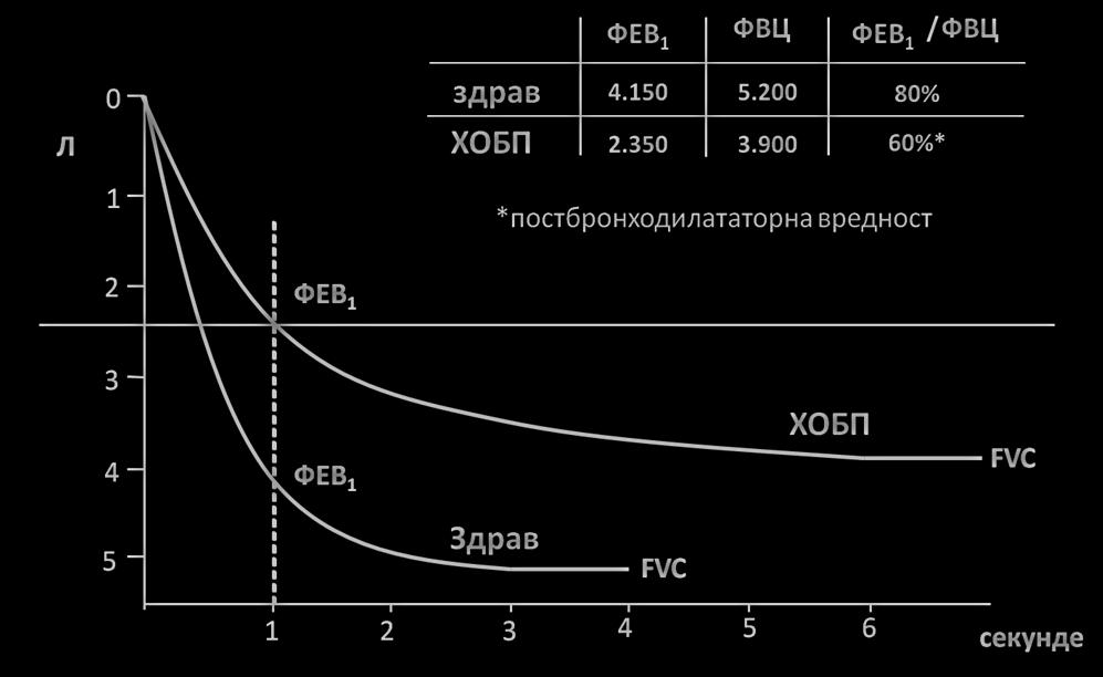 стадијума болести на основу степена тежине ограничења протока ваздуха: блага ХОБП - FEV1 80%