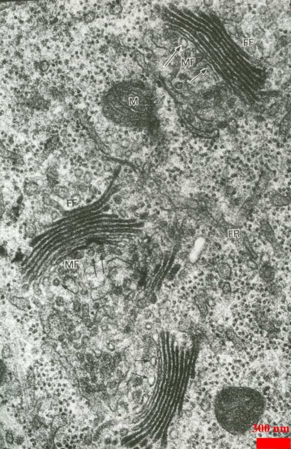 Ribosomas, endoplazmatiskais tīkls un Goldži komplekss Ribosomas un endoplazmatiskais tīkls Eikariotu šūnās citoplazmas ribosomas var atrasties uz kodola apvalka ārējās membrānas, uz endoplazmatiskā