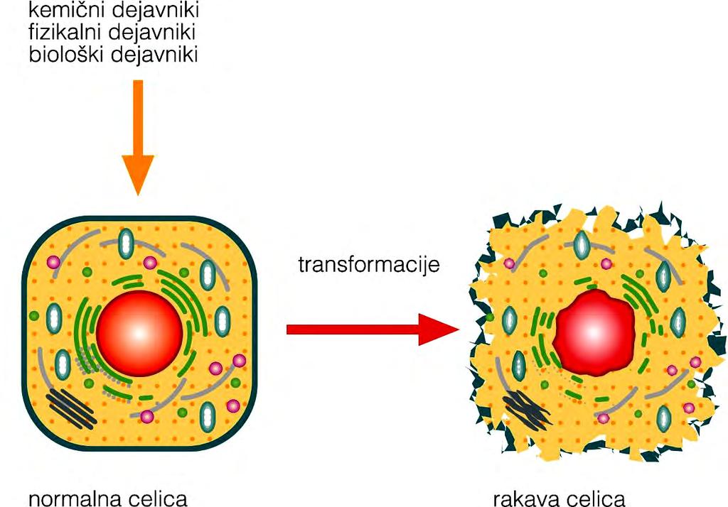 Maligna transformacija celice Sprememba normalne v rakavo celico