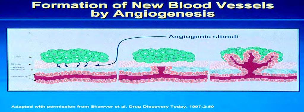 Angiogeneza-stopnje Tvorba in sproščanje angiogenih signalov s tumorskih in gostiteljskih celic Razgradnja ekstracelularnega