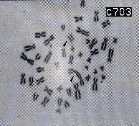 Kromosomske in kromatidne aberacije, ki povzročajo smrt celic A: Kromosomska aberacije