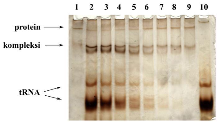 a.j. a.j. 4. Rezultati 4.3.1.