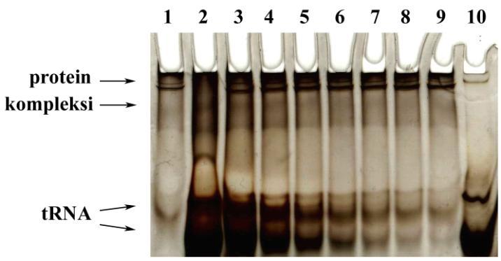Budući da kompleksi nisu dobiveni, uz sliku gela nije dana pripadna krivulja. (dolje) Titracija ΔN39MtArgRS (c = 3,71 μmol dm -3 ) s MttRNA Arg pri uvjetima niske ionske jakosti.