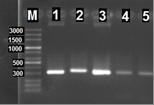 در تصویر الكترفورز ژل آگاروز محصول ژن اينتگرون با PCR رديف DNA ladder M رديف 2 و 3 جدایه سالمونال دارای ژن int رديف اشرشیاکلی ATCC 25922 به عنوان کنترل مثبت این مطالعه 26 از 3 سویه چند مقاومتی را