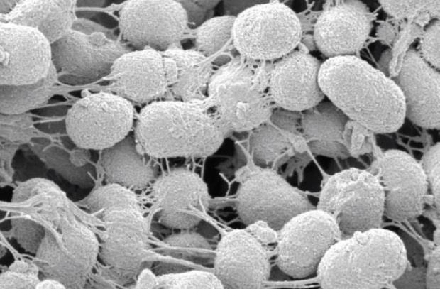 Treponema denticola, Tannerella forsythia, Fusobacterium nucleatum, Prevotella intermediaи Aggregatibacter actinomycetemcomitans. 2.4.