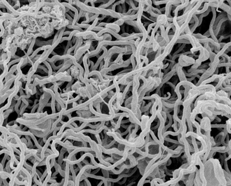 gingivalis поседује могућност везивања за ћелије оралног епитела у лабораторијским условима, што указује на његову вируленцију и значај у развоју пародонтопатије [29]. 2.4.