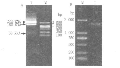 10 31 cdna CT cdna 1 600 bp 3B 2. 4 ACC CT pet-28a-ct 25 SDS-PAGE 1 62 ku 3 CT 4A Fig. 3 Ni SDS- PAGE 4B 1.