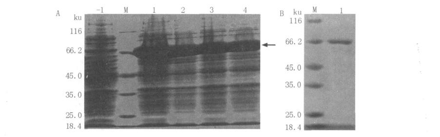CT SDS-PAGE Fig.