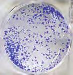 TCF7L2 in DLD-1 (KRAS G13D) cells.