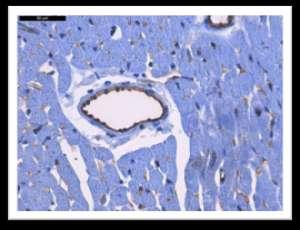 Слика 8 и 9 H/E (хематоксилин/еозин) бојење ћелија На слици 8 се уочава кариопикноза једара и