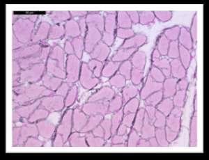 Слика 24 РТАН (фосфоволфрамска киселина хематоксилин) и слика 24 R (ретикулинско) бојење ћелија На слици 24.