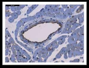 РЕЗУЛТАТИ На сликама 28 и 29 се уочавају раздвајања миофибрила са једне стране ћелије и груписање са друге стране ћелије, тј.