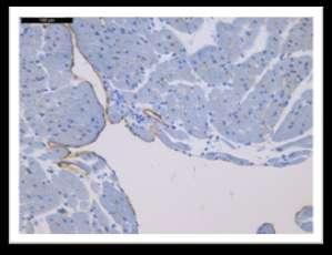 вакуолизација ћелија. На слици 87 се уочава очуваност интерстицијалног везивног ткива.