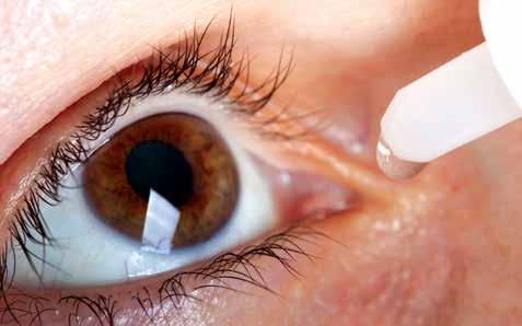 Otekle veke, podočnjaki, utrujenost, razdraženost in suhost očesne sluznice imajo različne vzroke.