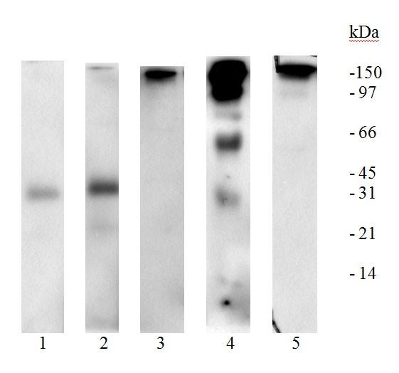 je izvršeno blokiranje anti-igfbp-1 antitela rastvorom rhigfbp-1 (poglavlje 3.9), a zatim je urađen imunoblot koristeći serum kao uzorak.