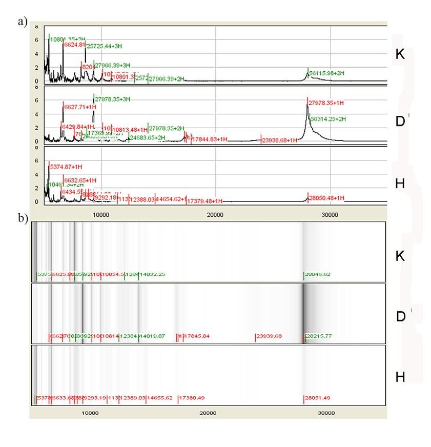Tipični maseni spektri, prikazani kao standardni profili i denzitometrijske trake u opsegu m/z 1-30000, za sve tri grupe ispitanika, dati su na Slici 26. Slika 26.