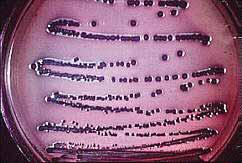 H 2 S,, -. Escherichia,, E. blattae.. Escherichia. Escherichia coli ( ). E. coli,.