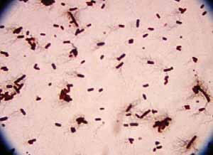 . 96. Proteus vulgaris (http://biology.clc.uc.