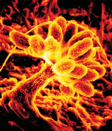 .,, -, (. 100).. 100. Stigmatella aurantiaca (Photo by David White colorized by Yves Brun using NIH Image) 100 600 -. : -,. -. : - 58 60 º 10 60.