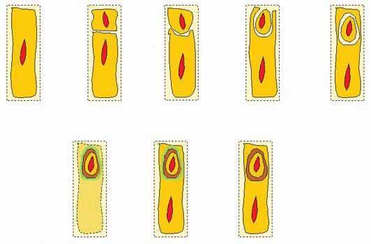 . -,. spo, - Bacillus subtilis (. ) 100. spo-. (. 20):.