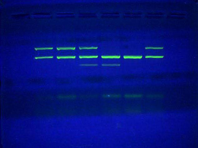 1 2 3 4 5 6 Слика 10 PCR продукти раздвојени на 2% агарозном гелу: линије 1, 2, 6 особе са GSTT1 позитивним и GSTM1 нултим генотипом; линија 3 особа са GSTT1