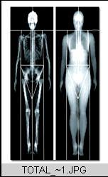 محاسبات ومقادیر مرجع Appendicular muscle (ASM)?