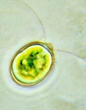 ..) - Vodne bolhe (Daphnia sp.