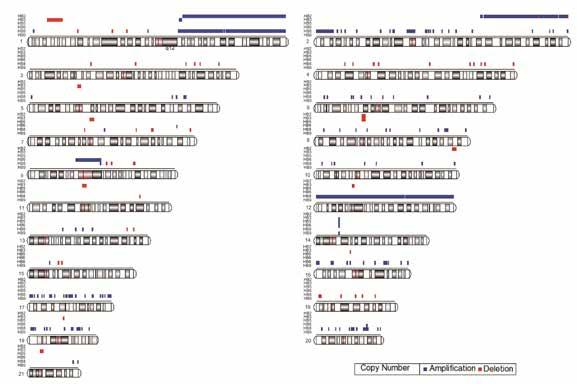 Supplementary Figures Supplementary Figure S1. The genomic landscape of somatic copy number alterations in 6 HB samples.