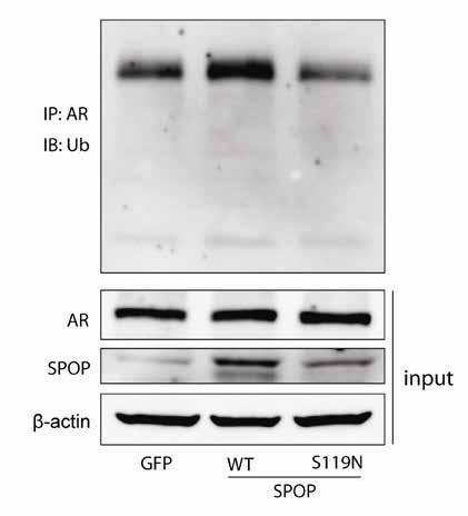 Supplementary Figure S5. SPOP promotes ubiquitination of Androgen receptor.