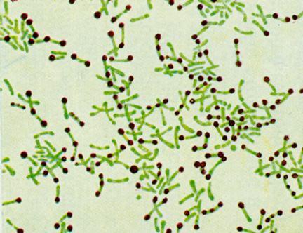 GENUL CORYNEBACTERIUM bacili Gram pozitivi in frotiu - forma de