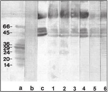 Слика 8 Резултати Western blot теста са карактеристичним тракама (45, 49 и 53 kda) Узорци су сложени са лево на десно.