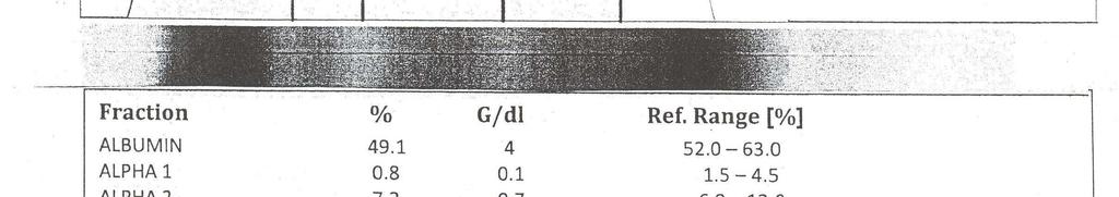 %8.5.4 3.1 WBC = 11300 PMN = %69 Lym = %28 Mon = %3 RBC = 4/64 106 hemoglobine = 11/5 Hct = 35/8 MCV= 77 PLT = 256000 ESR = 10 CRP = - AST = 47 ALT = 20 AlP = 191 T.Bil = 1 D.
