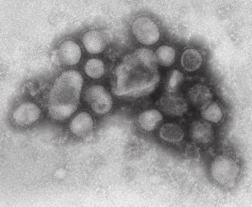Virus
