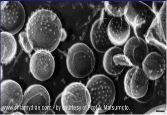 (azithromycin και clarithromycin) Clamydophila pneumoniae Moraxella