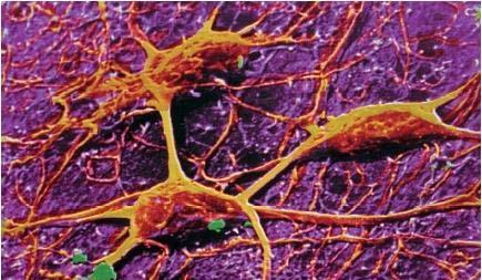 sinapse ekscitacijske (signal na aksonu - signal na dendritu) ali inhibicijske (signal "negirajo") soma glede na signale z dendritov in