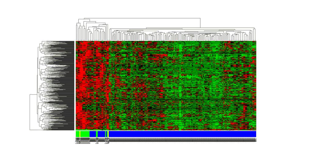 Supplementary Figure 10. Gene expression profiling associated with SETBP1 mutation. Expression array results were obtained from TCGA data portal (http://tcga-data.nci.nih.gov, LAML dataset).