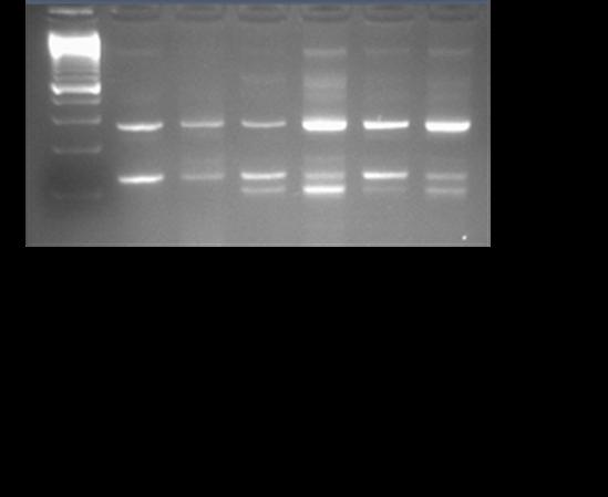 a b Supplementary Figure 2. Allele specific PCR for detecting SETBP1 and p.gly870ser alterations.