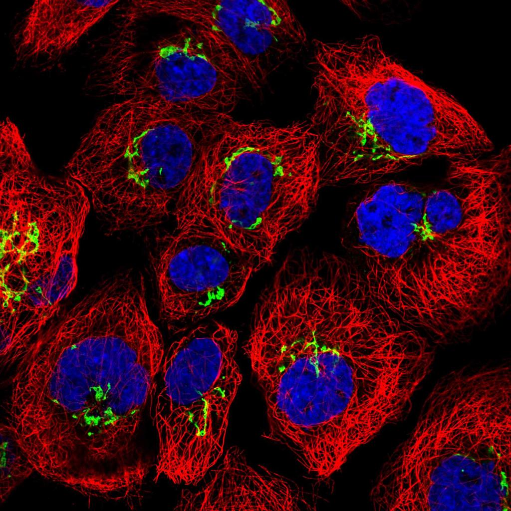 fraction Cell lysate centrifugation Pure fraction catalogue Subtractive proteomics (enrichment) Figure: Immuno