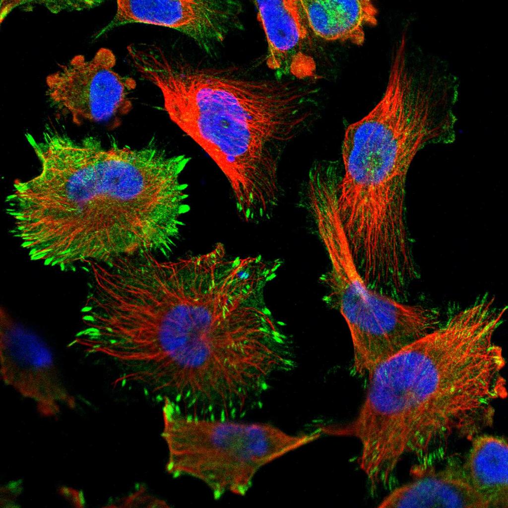 Also detected in the nucleus (right).