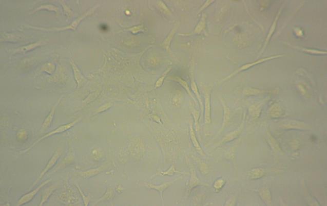 Goat serum اضااافه شااد و پااس از تااارج کااردن serum آنتیباادی اولیاه alpha A+ alpha B crystalline antibody رقیق شاده در Phosphate Buffered Saline ( BSA/PBST albumin/tween-20 )Bovine serum 1/4 درداد