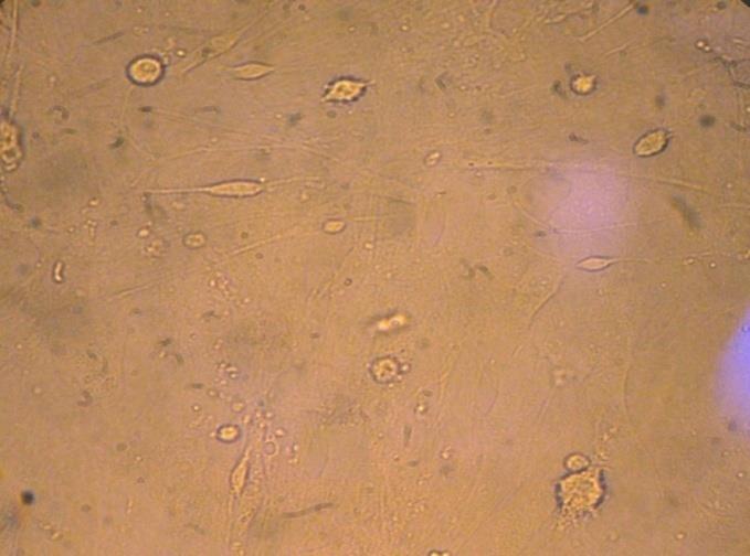 آنتیبادی ثانويه رقیاق شاده در 1/4 BSA/PBST دردد باهماد 11 دقیقاه در دماای اتااق اضافه شد. از میثروسثوپ معثاوس فلورساانس جهات ارزياابی سلولها استفاده شد.